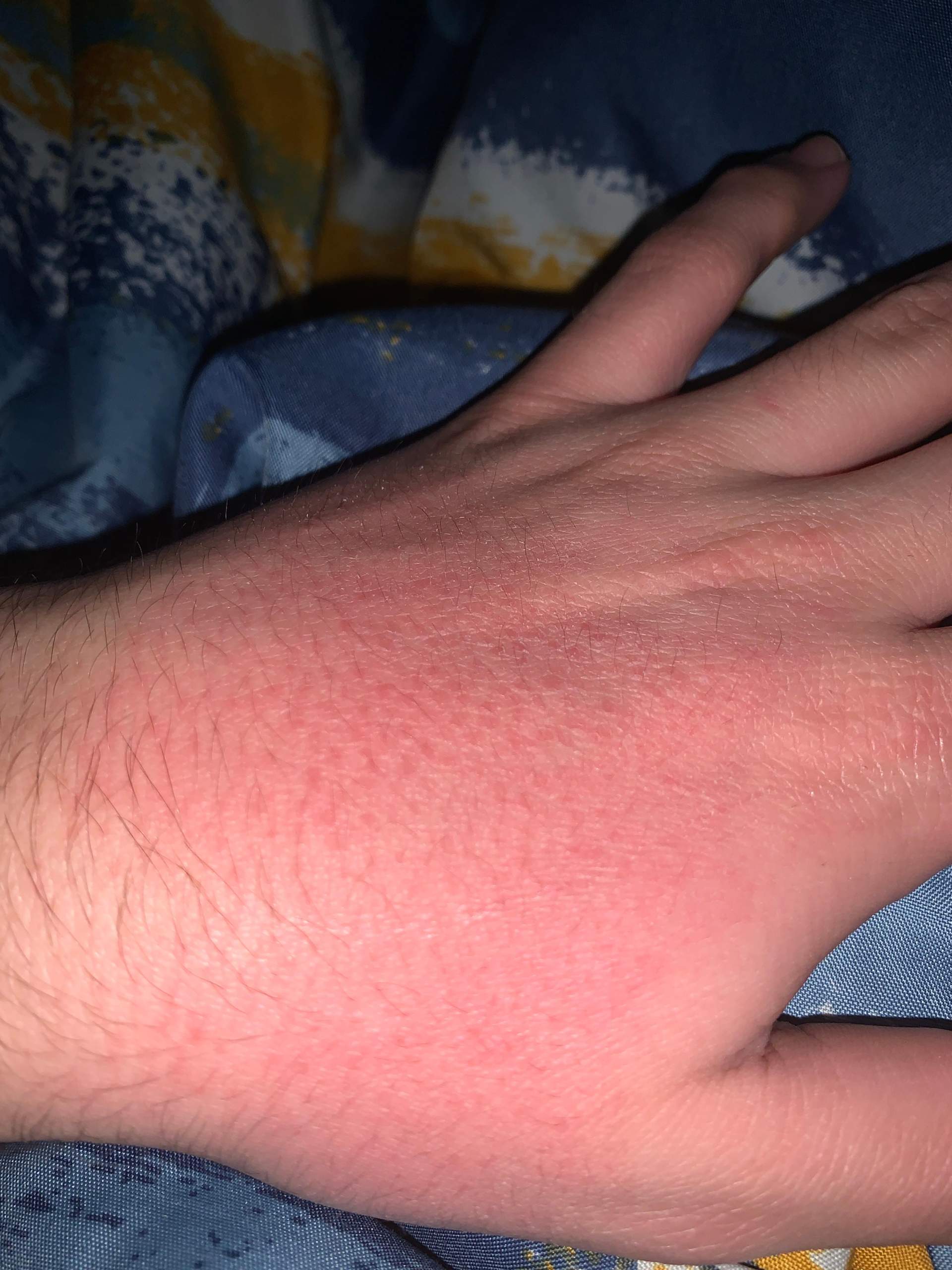 Aknenormin rezeptfrei kaufen